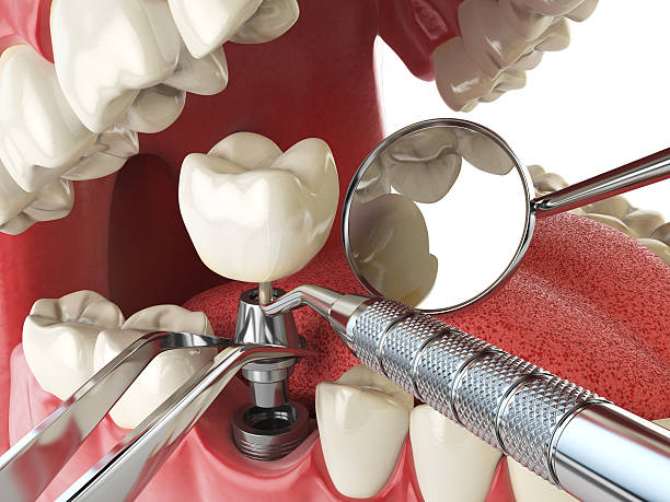 Best Emergency Dentist for Knocked-Out Tooth in Trion, GA